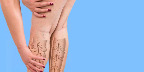 Lymphaselect: studi clinici sul nuovo ingrediente per migliorare il microcircolo