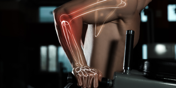  I 5 migliori integratori per le ossa e le articolazioni