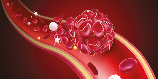 I 5 migliori integratori per la circolazione del sangue