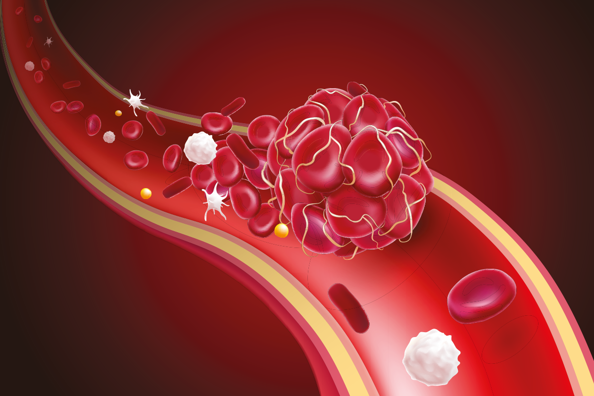 I 5 migliori integratori per la circolazione del sangue